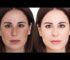Los secretos mejor guardados sobre : Cómo quitar las manchas de la cara inmediatamente y lucir una piel radiante en cuestión de minutos.